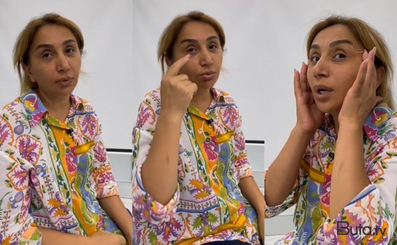  Plastik əməliyyatı pisləyirdi, indi özü də etdirir 