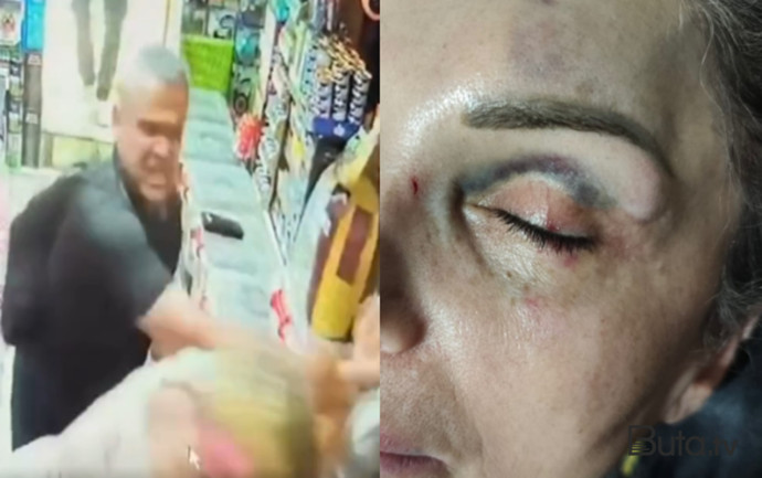  Qadını mağazada döydü - Saxlanıldı+Video  