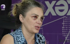 Bakıda mağazada döyülən qadın danışdı - Video