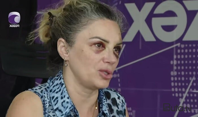  Bakıda mağazada döyülən qadın danışdı - Video  