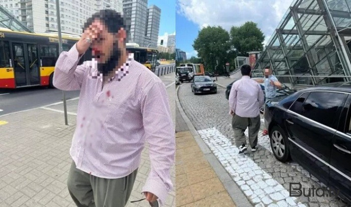  Polşada azərbaycanlı taksi sürücüsünü döyənə cinayət işi açıldı  