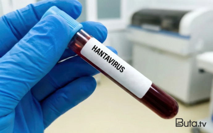  Hantavirus insandan insana nadir halda keçir - Rəsmi  
