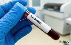 Hantavirus insandan insana nadir halda keçir - Rəsmi