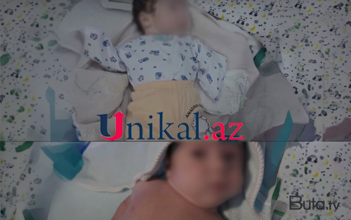  Ana qolları olmadığı üçün körpəsindən imtina etdi - Foto  