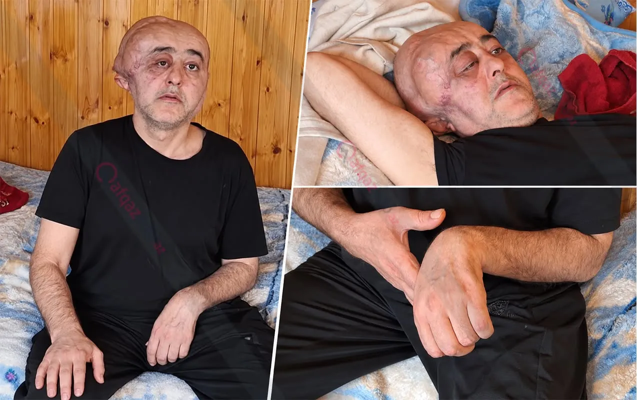 Siz aylardır həll edilməyən problemi bir neçə saata necə həll etdiniz?