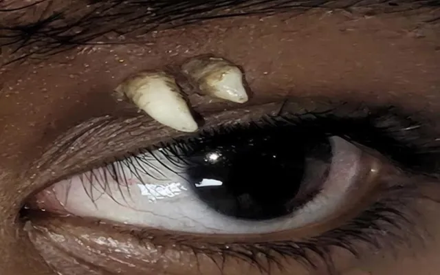 16 yaşlı oğlanın gözündən diş çıxdı - Fotolar