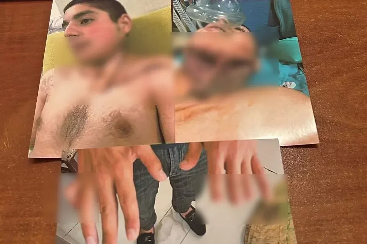 Əlillik ala bilməyən qazi ilə bağlı TƏBİB-dən açıqlama: "Meyarlara uyğun deyil"
