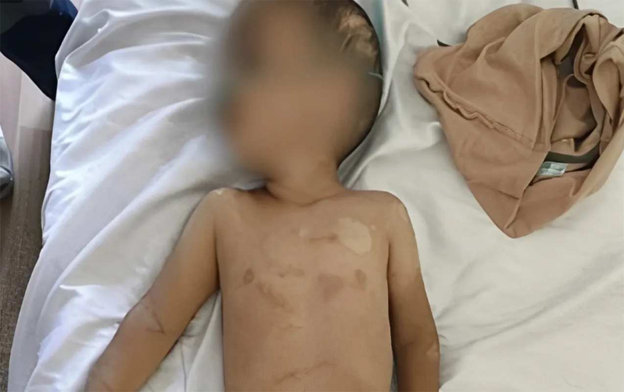 Həmin 3 yaşlı uşağın anasının valideynlik hüququ məhdudlaşdırıla bilər - Foto - Yenilənib
